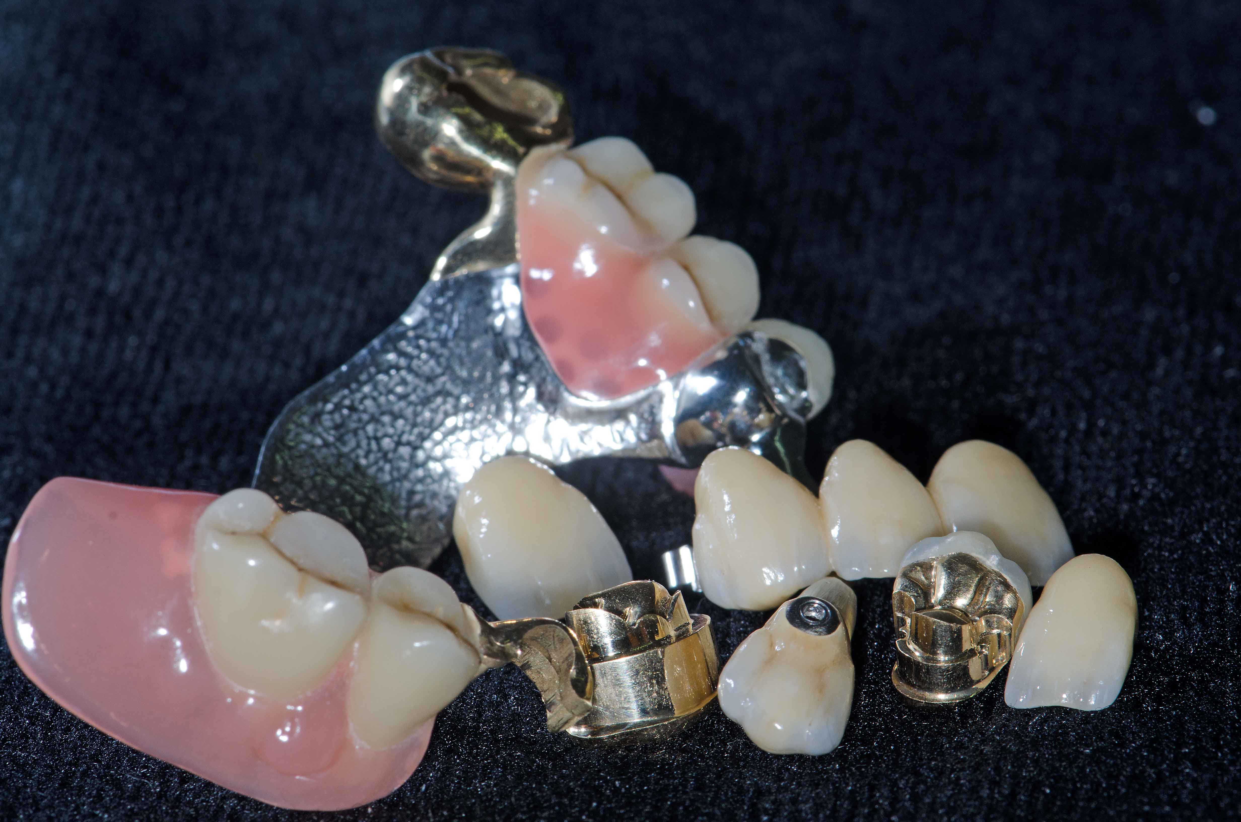 Dentallabor Bernini und Wicki AG